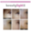Thumbnail: Beautylight II Photo Dynamic Thermo Therapy